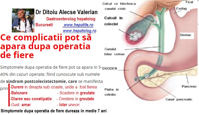 Probleme dupa operatia de fiere