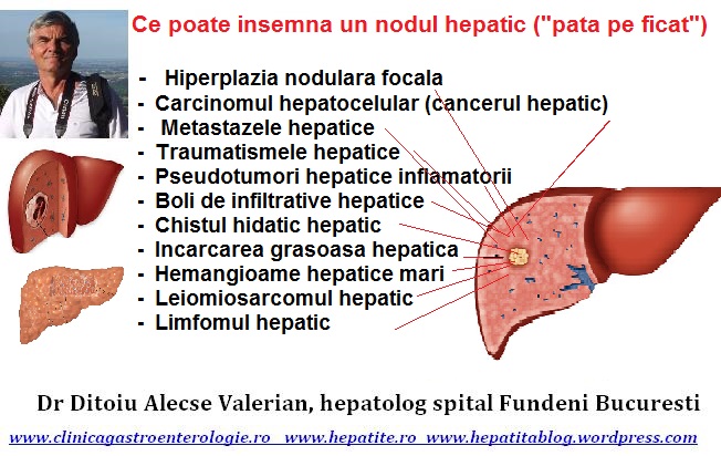 cancer hepatic evolutie