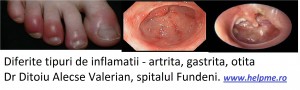 Inflamatii