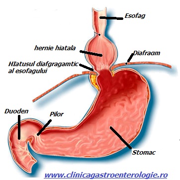 regim alimentar dupa operatia de adenom de prostata morcovi în tratamentul prostatitei