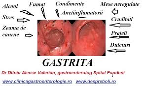 Regim-stomac