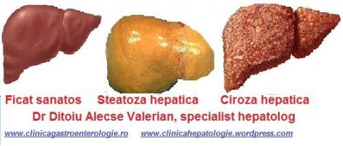Logo Evolutia steatozei (1)