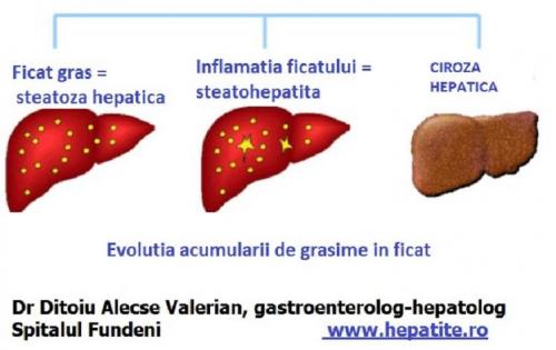 STEATOZA HEPATICA (1)