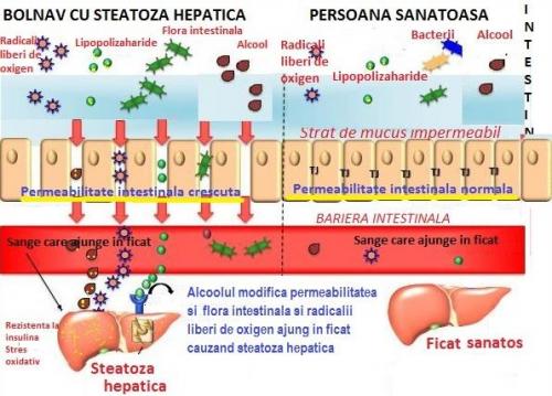 Steatoza hepatica nonalcoolica (1)