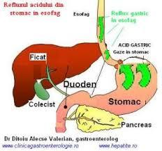 reflux acid